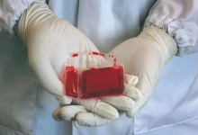 脐带血是否值得花钱保存？
